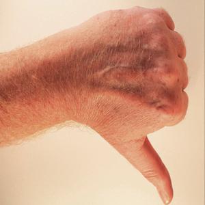 Hand mit Daumen runter