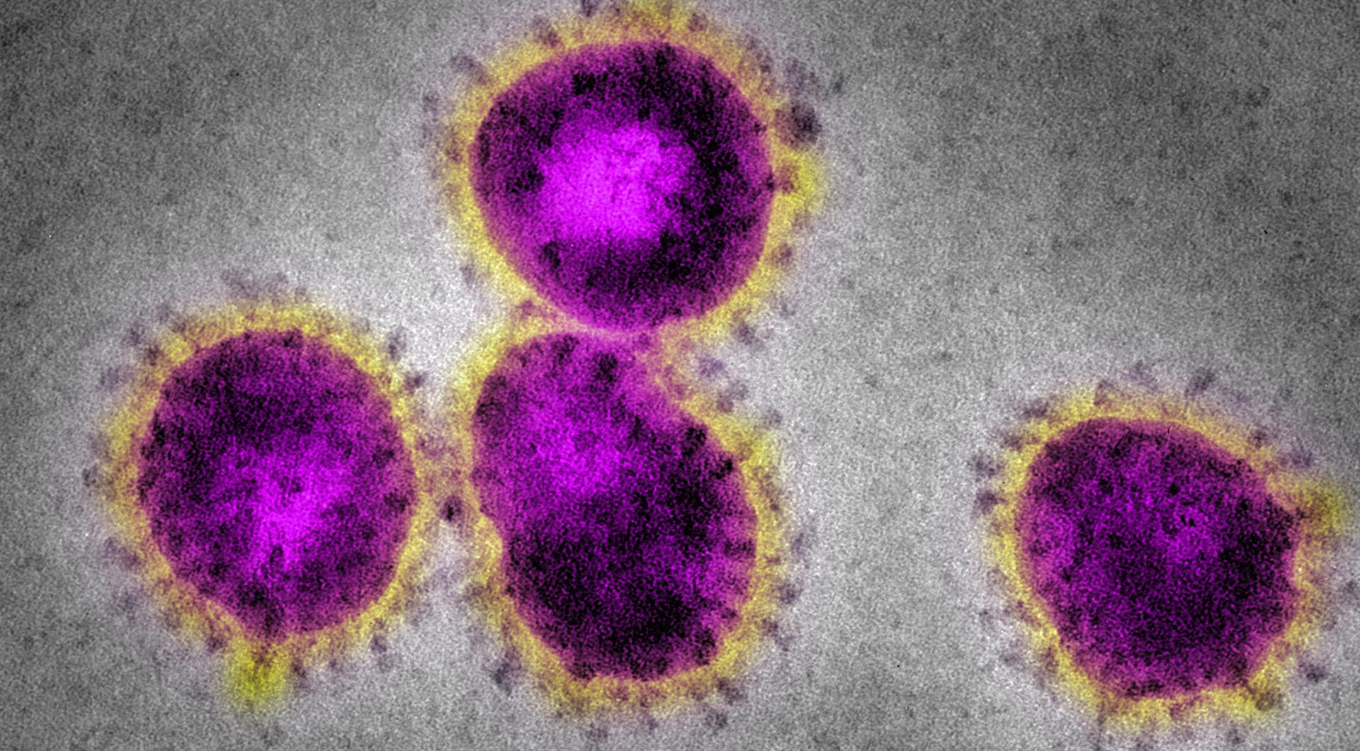 Grafik zeigt Corona-Virus auf der Webseite der WHO