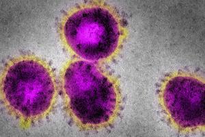 Grafik zeigt Coronavirus