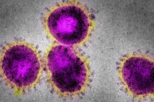 Grafik zeigt Corona-Virus auf der Webseite der WHO